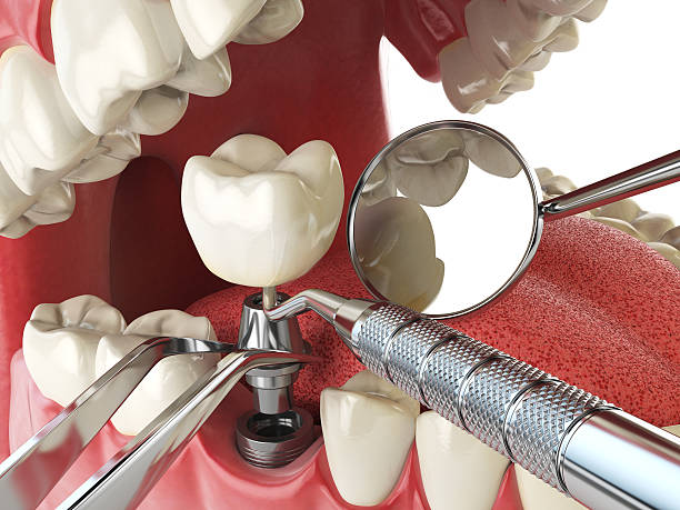 Best Same-Day Emergency Dentist in Frankfort Square, IL